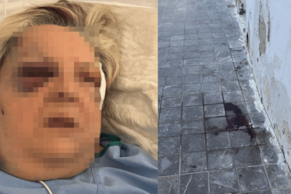 Brutal agresión a una mujer de 71 años en Campanar: Golpes, patadas y pisotones en un ataque salvaje