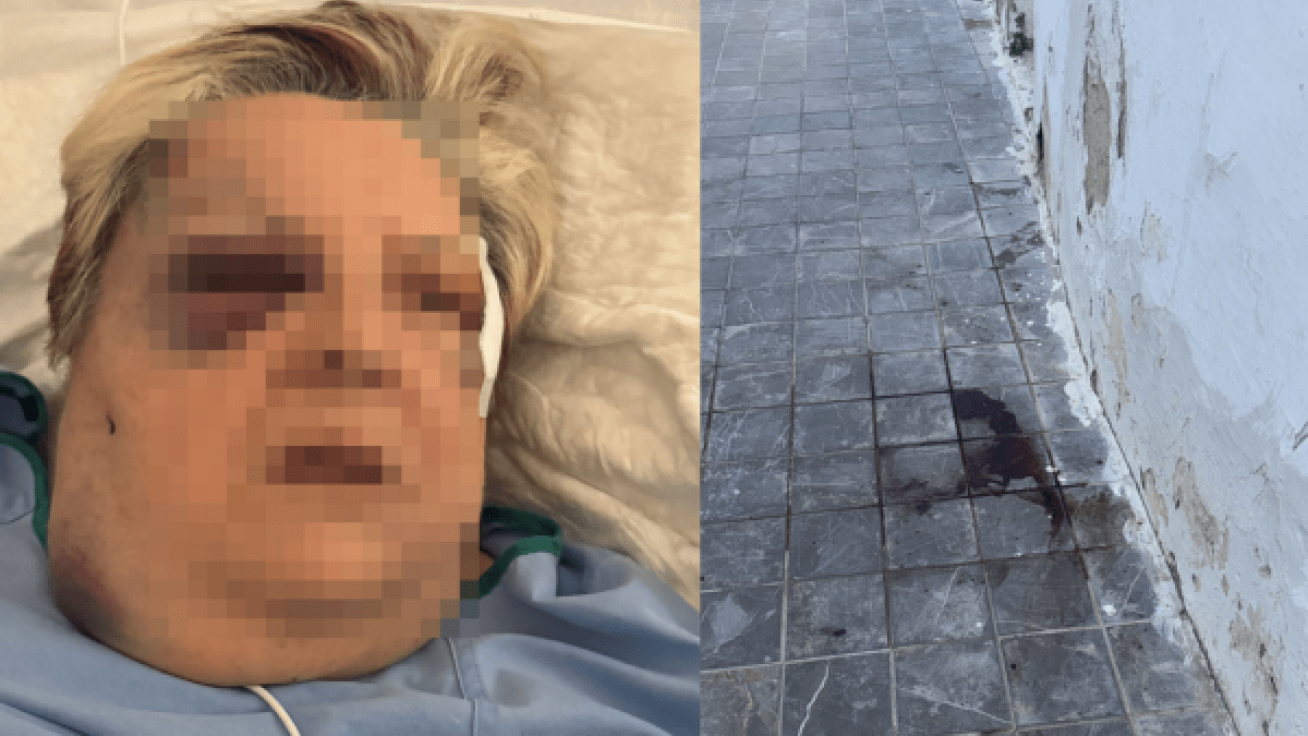 Brutal agresión a una mujer de 71 años en Campanar: Golpes, patadas y pisotones en un ataque salvaje