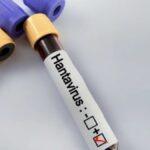 Hantavirus en Alicante: El Centro Nacional de Microbiología examina la última muestra para confirmar su resultado negativo