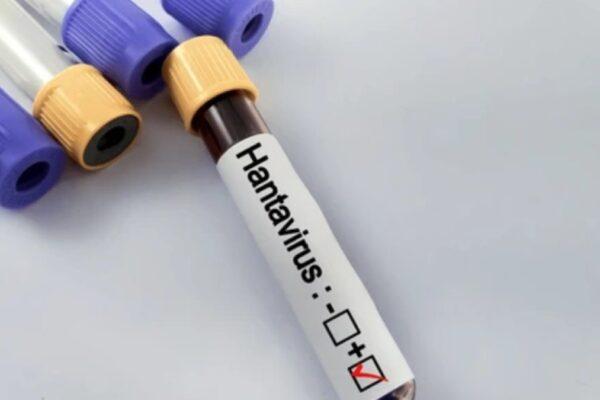 Hantavirus en Alicante: El Centro Nacional de Microbiología examina la última muestra para confirmar su resultado negativo